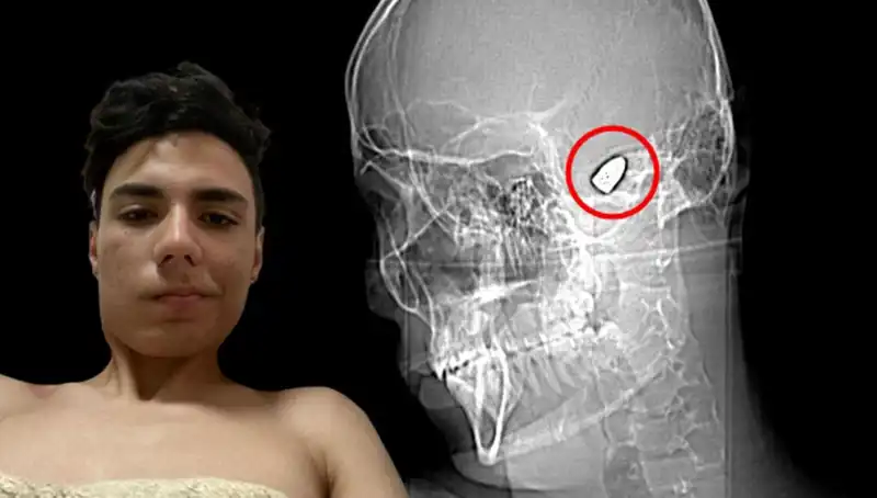 Zihnindeki Patlayıcı: Bir Adamın Korkunç Hikayesi