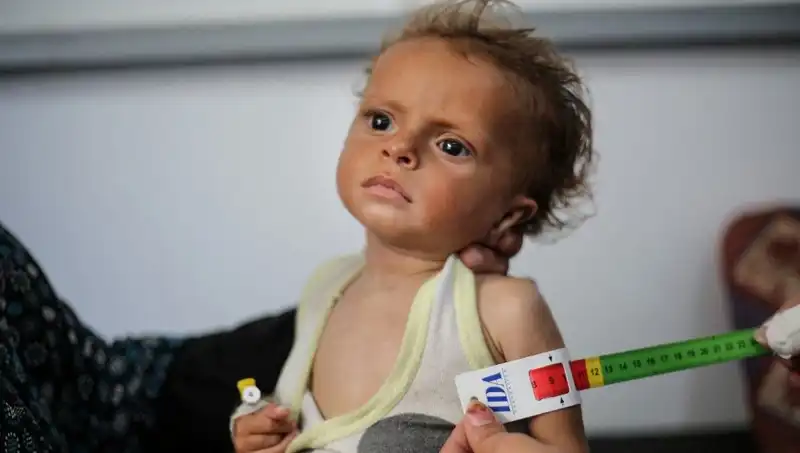 İngiltere, 300 Gazzeli Çocuğa Yeni Bir Hayat Sunacak!
