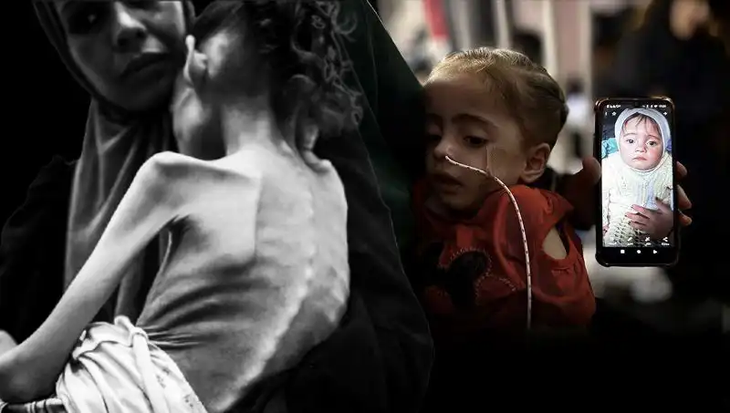 Küçük Meryem'in Dramı: 25 Kilodan 10 Kiloya Düştü ve Açlıkla Mücadele Ediyor