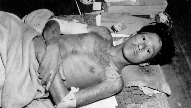 80 Yıl Sonra Nagasaki'den Gelen Tarihi Uyarı: Nükleer Tehdit Gerçekleşebilir!