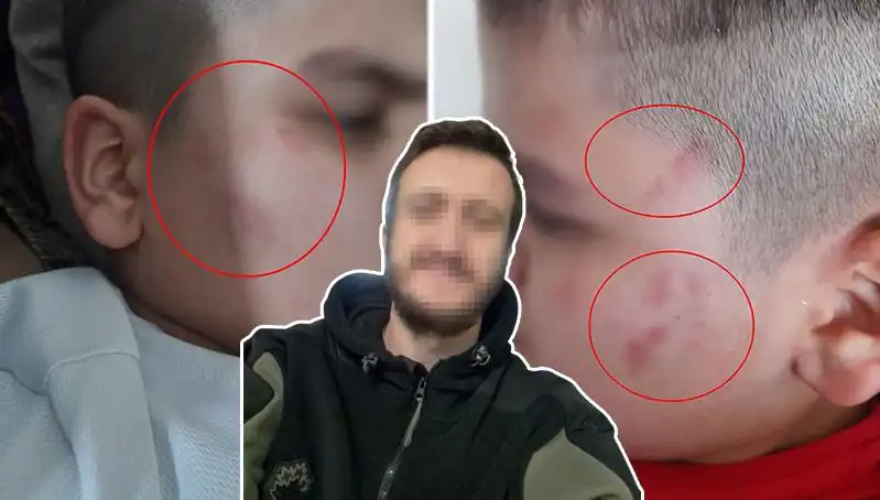 Okulda Otizmli Çocuğa Dayak İddiası: Aile Kapıları Zorlayacak