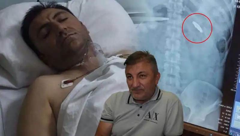 15 Temmuz Geçmişi: Kurşunla İçimizde Taşıdığımız Yaralar